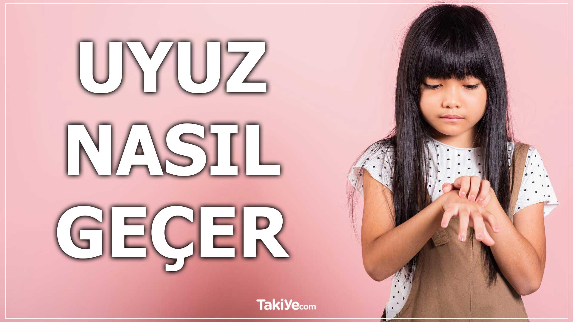 uyuz nasıl geçer