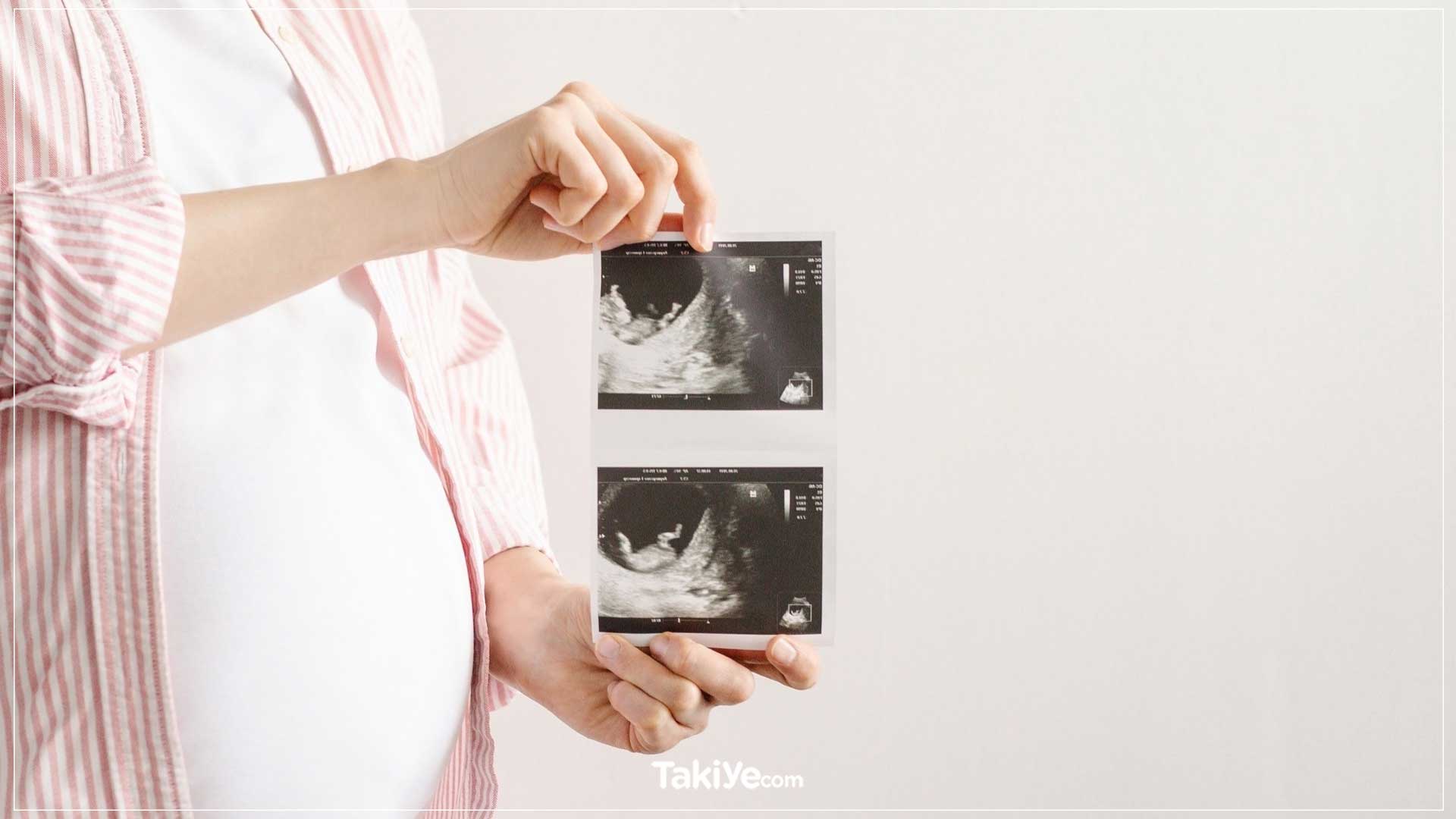 hamileliğin 18. haftası ultrason görüntüsü