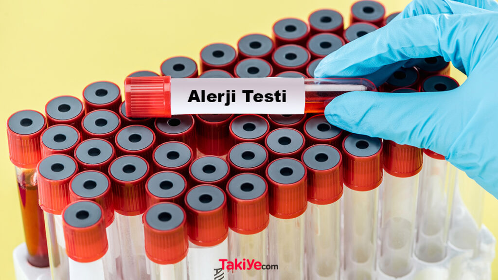 alerji testi fiyatları