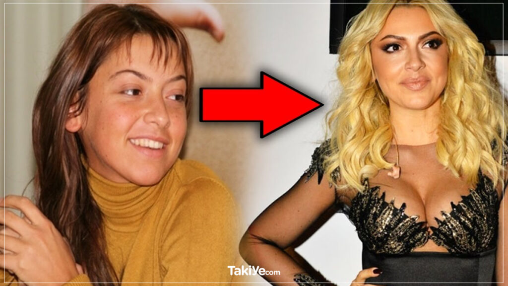 hadise estetiksiz hali, eski hali, makyajsız hali